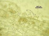Dettaglio di un soro di organi uniloculari